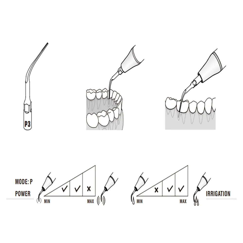 Woodpecker Scaler Tip P3 for UDS  EMS Scalers_2.jpg