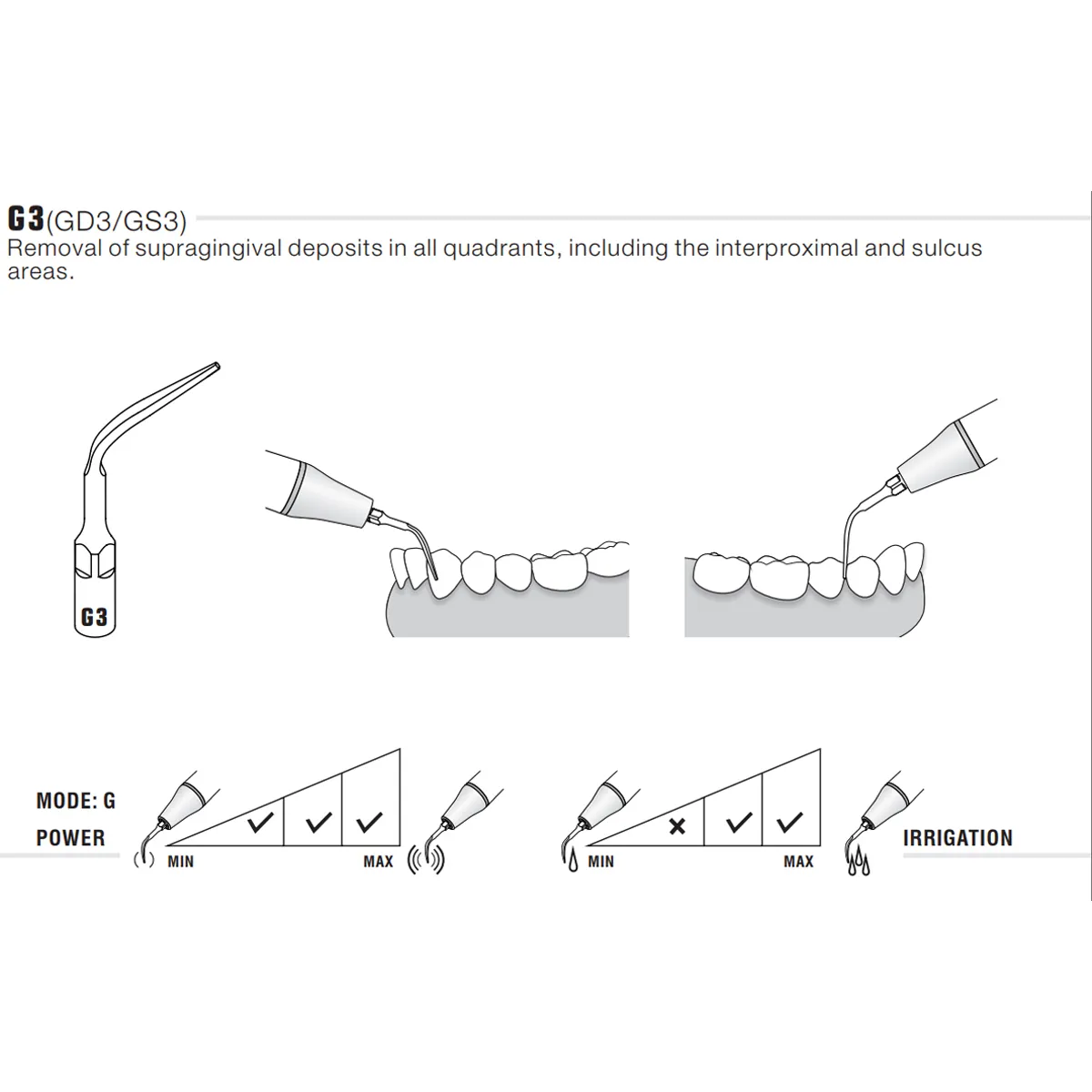 Woodpecker Scaler Tip G3_2.jpg