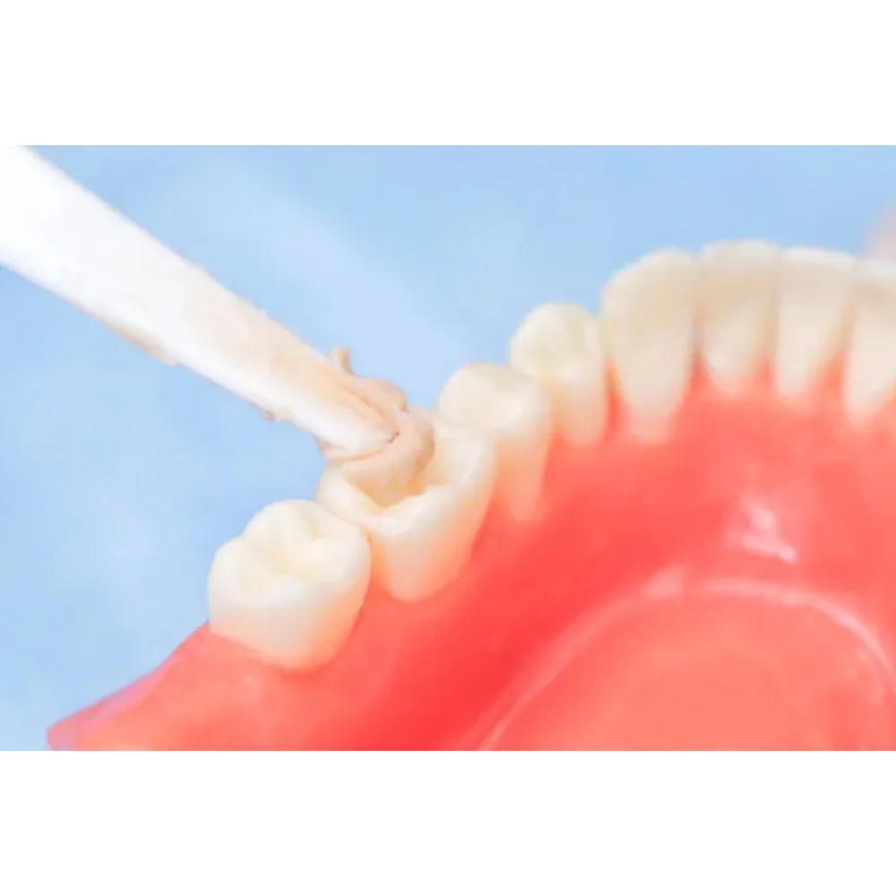 Spident BaGIC ll Glass Ionomer Filling Material